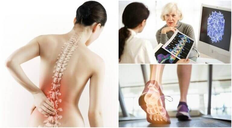 остеопороз и боль в спине