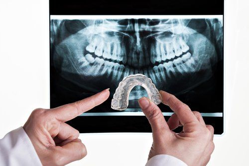 Рентгеновская и зубная вставка