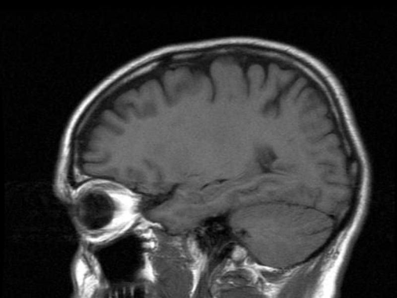 Каково влияние мозговой работы и нейротрансмиттеров на беспокойство?