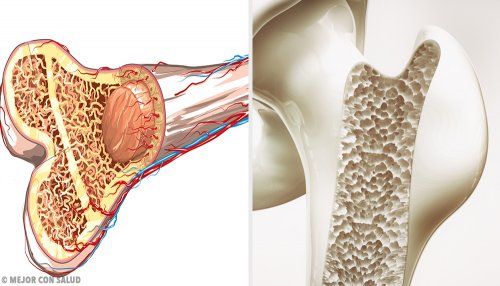 Поперечное сечение кости остеопороза
