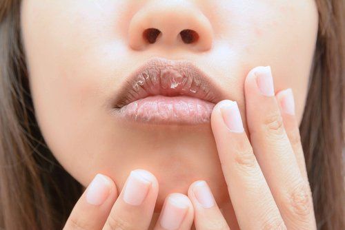 Сухие губы и нехватка вещества