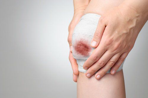 Раненное колено