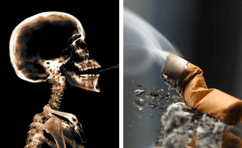 Последствия курения