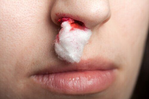 Кровоизлияние из носа, витамин k