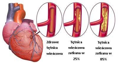 3 #: Сердечная недостаточность - heart disease.jpg
