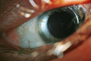 Сетчатка глаза